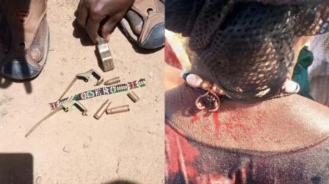 Bullet casings and injured community member side-by-side images.